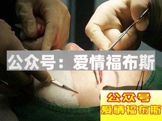 关于整容，你敢这样做吗？第7张