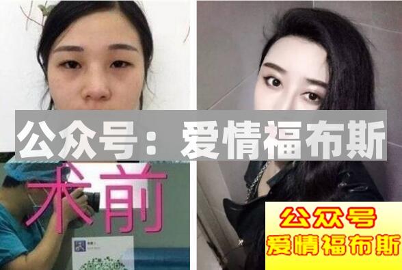 关于整容，你敢这样做吗？第4张