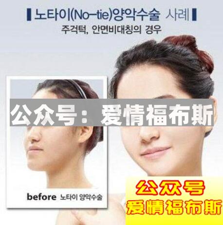 关于整容，你敢这样做吗？第10张