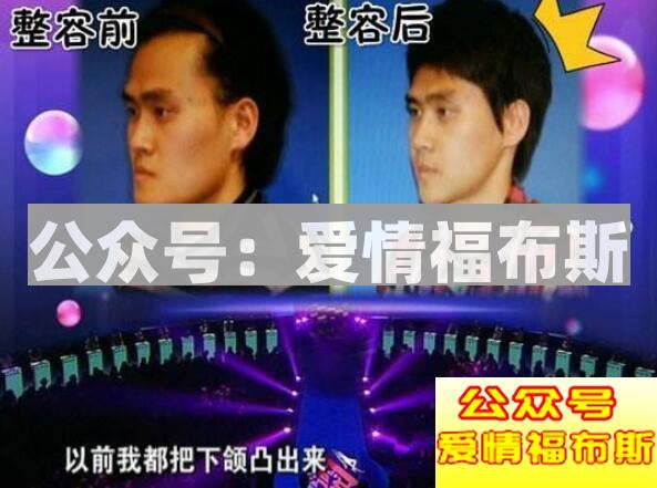 关于整容，你敢这样做吗？第12张