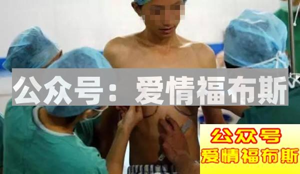 男变女变性人的故事第2张