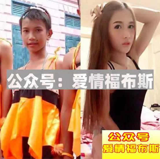 整容会帮你成为人生赢家吗第3张