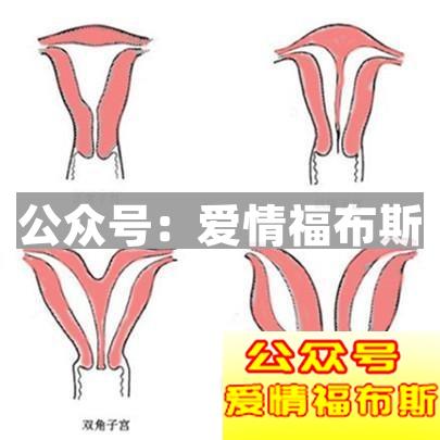 揭秘那些不一样的性奇闻第5张