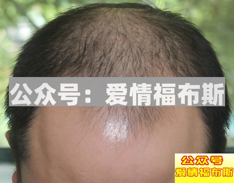 男生形象改造前后对比图(附全攻略)第4张