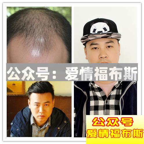 男生形象改造前后对比图（附全攻略）第7张