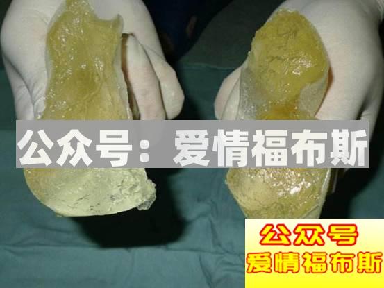 致你的人生：蹦4000的迪，约400的炮，吃4块钱泡面，抢4毛钱红包第13张